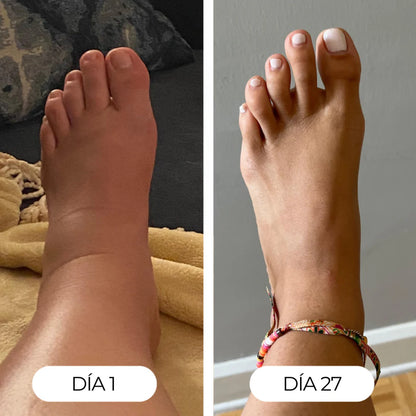 Drenaje Linfático Líquido - Reduce la hinchazón y recupera tu silueta.