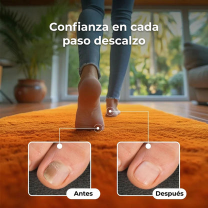 Nutrovy Eliminador de Hongos