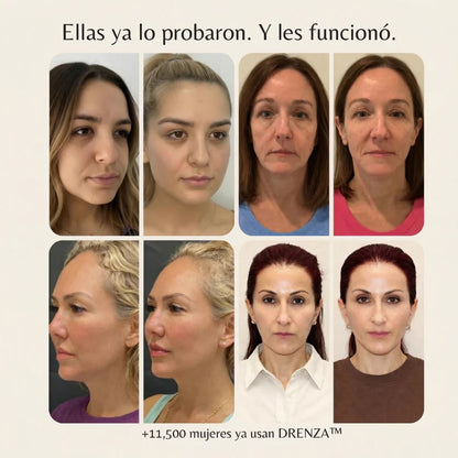 Cepillo Linfático - Realza tus Facciones en Minutos