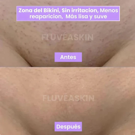 Lunéa™ - Vello fino y menos visible con Raiz de Cyperus Rotundus